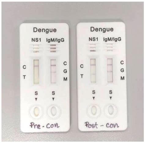 dengue test kit result interpretation